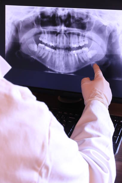 Best Emergency Dental Services for Seniors in Cottage Lake, WA